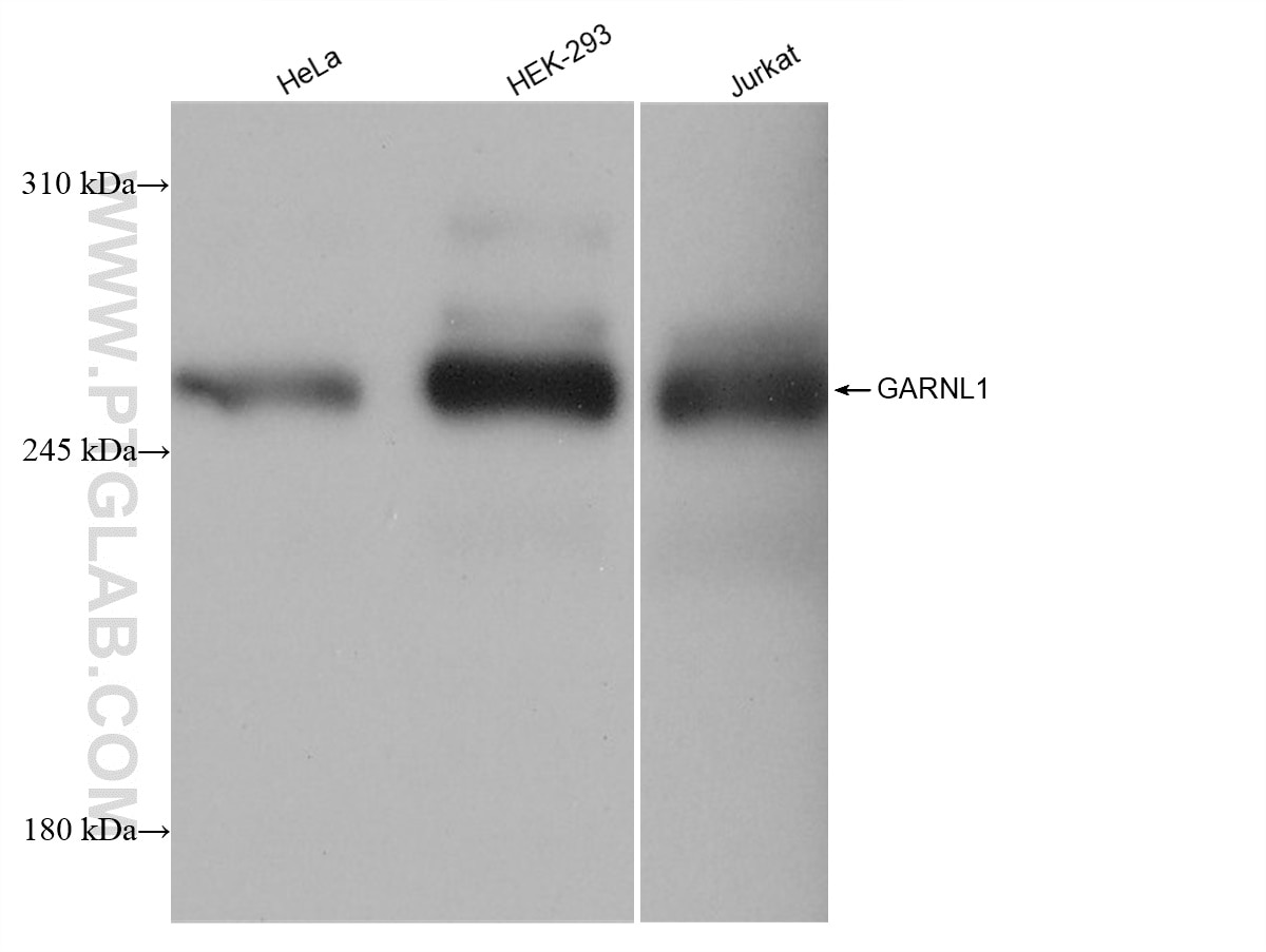 Western Blot (WB) analysis of various lysates using GARNL1 Recombinant antibody (82971-1-RR)