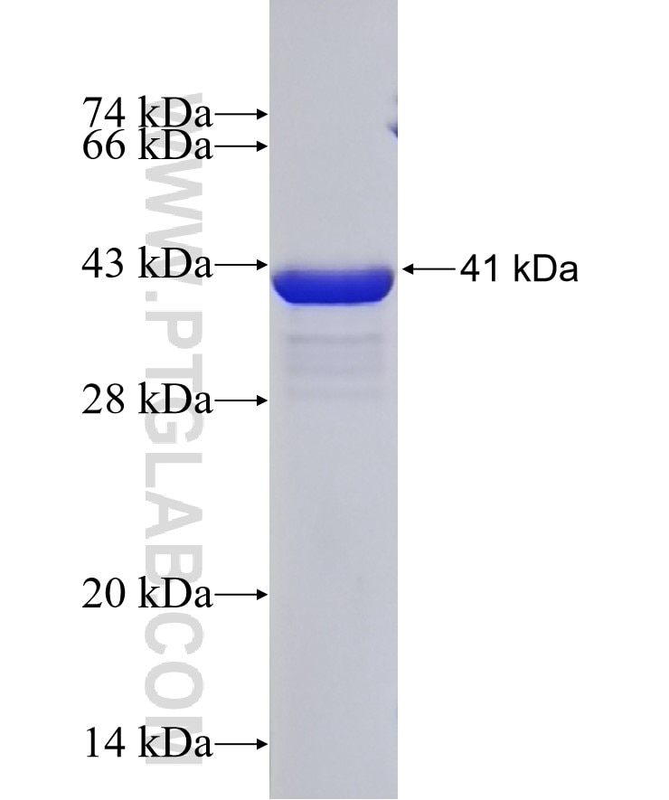GARNL1 fusion protein Ag31518 SDS-PAGE