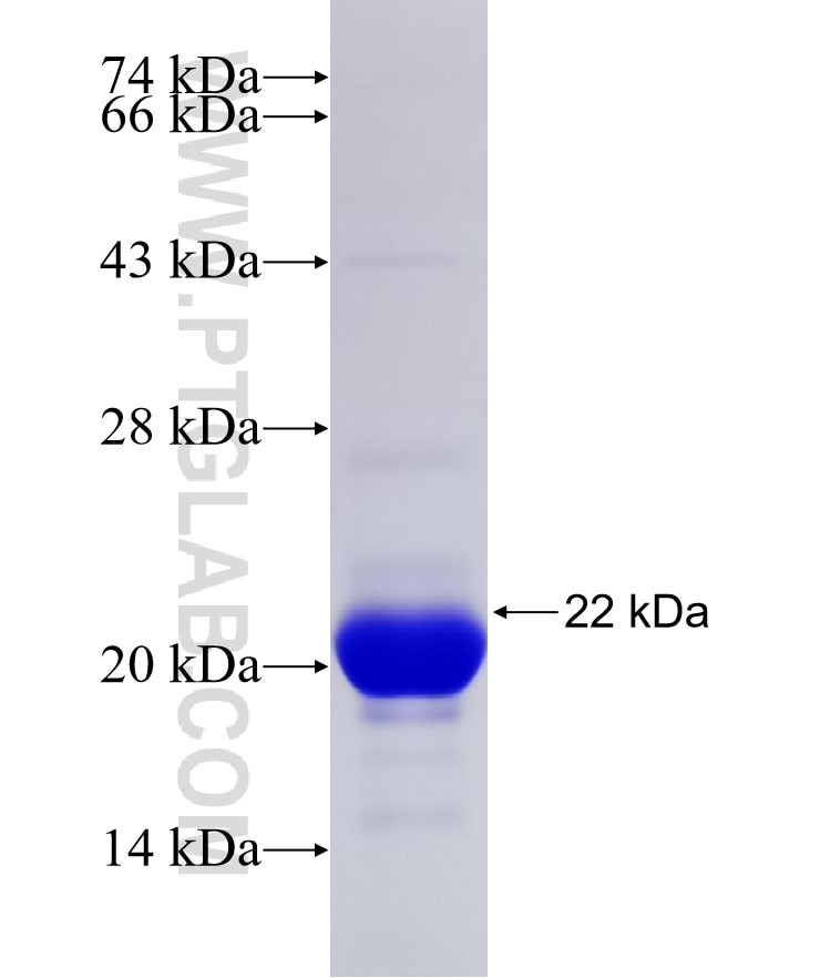 GARNL1 fusion protein Ag31546 SDS-PAGE GARNL1 fusion protein Ag31546 SDS-PAGE