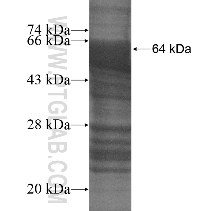 GARNL3 fusion protein Ag10974 SDS-PAGE
