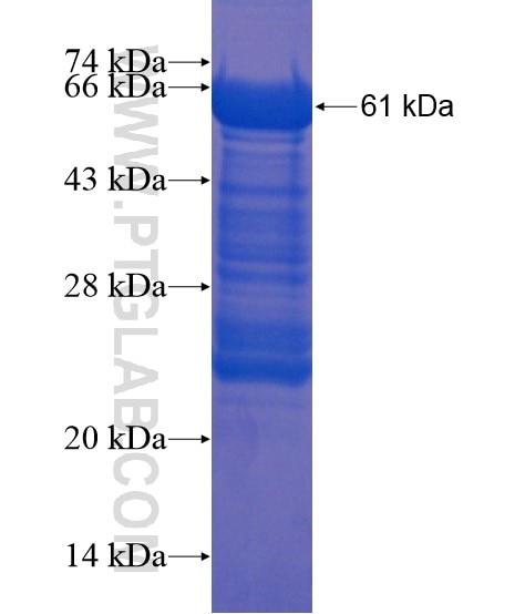 GARNL4 fusion protein Ag21840 SDS-PAGE