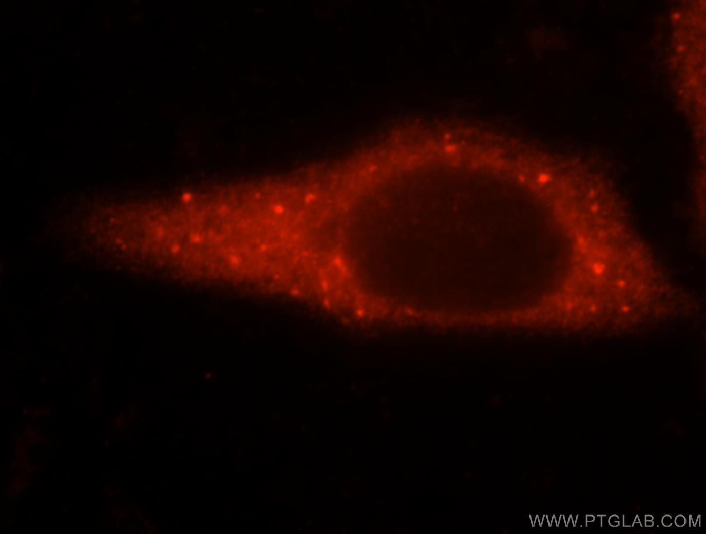 Immunofluorescence (IF) / fluorescent staining of HepG2 cells using GARS Polyclonal antibody (15831-1-AP)