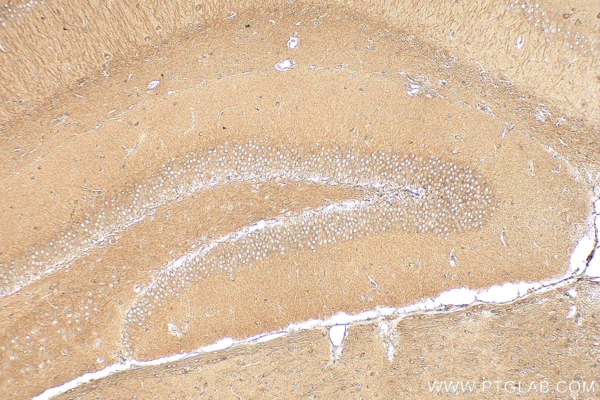 Immunohistochemistry (IHC) staining of mouse brain tissue using GARS Polyclonal antibody (15831-1-AP)