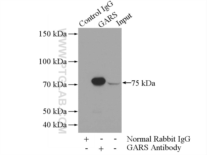 Immunoprecipitation (IP) experiment of mouse liver tissue using GARS Polyclonal antibody (15831-1-AP)