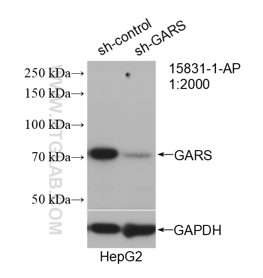 Western Blot (WB) analysis of HepG2 cells using GARS Polyclonal antibody (15831-1-AP)