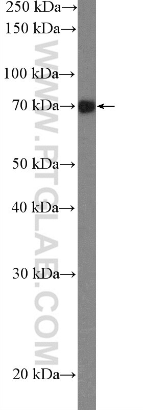 Western Blot (WB) analysis of HepG2 cells using GARS Polyclonal antibody (15831-1-AP)