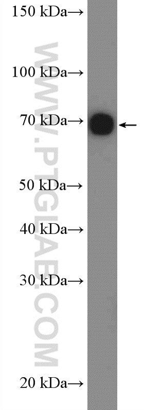 Western Blot (WB) analysis of HeLa cells using GARS Polyclonal antibody (15831-1-AP)