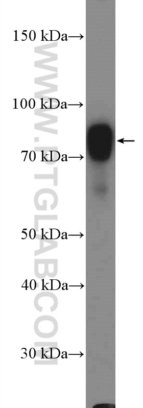 Western Blot (WB) analysis of HT-1080 cells using GARS Polyclonal antibody (15831-1-AP)