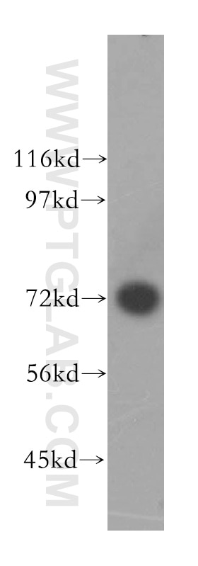 Western Blot (WB) analysis of human brain tissue using GARS Polyclonal antibody (15831-1-AP)