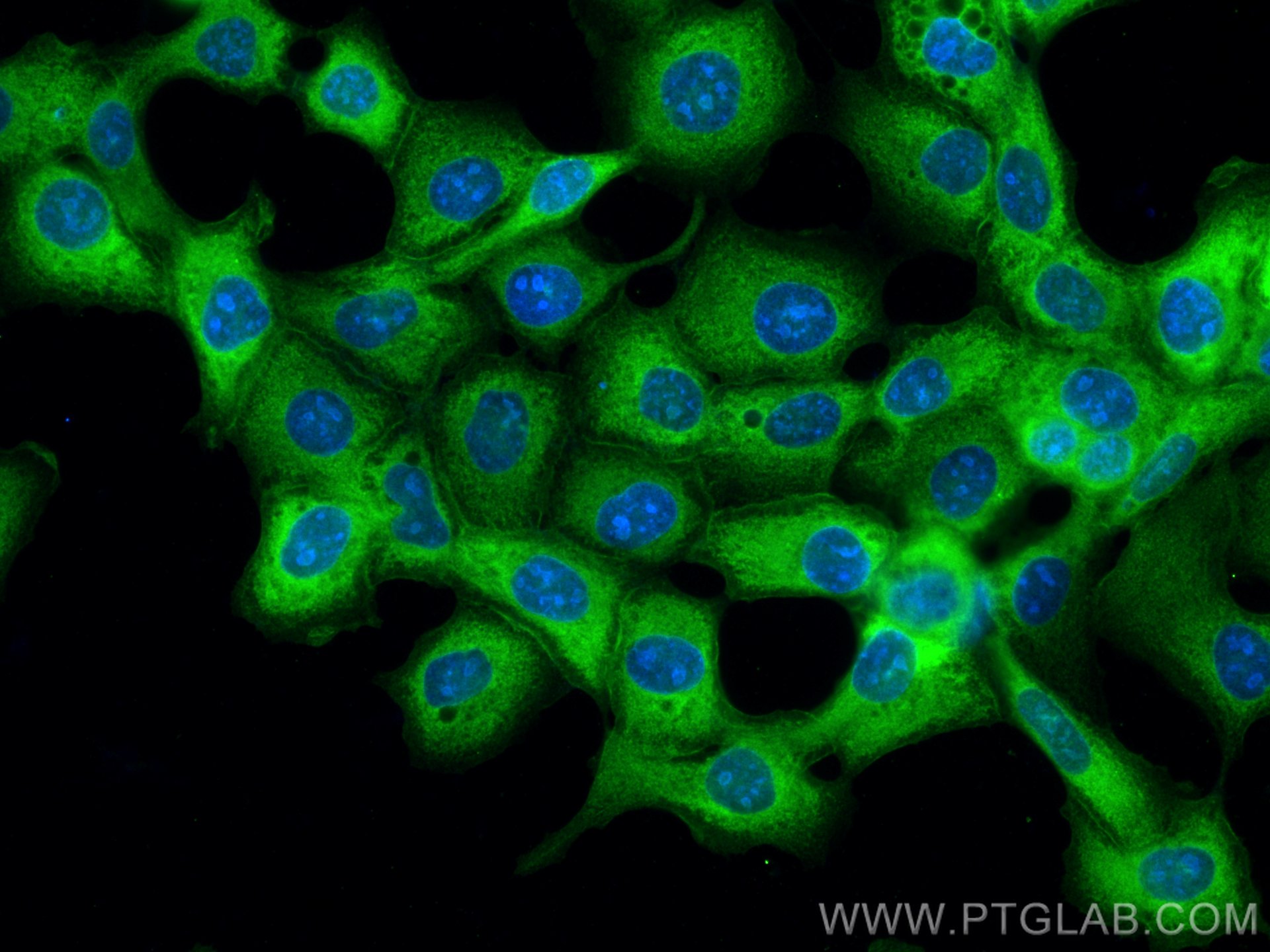 Immunofluorescence (IF) / fluorescent staining of A431 cells using GARS Monoclonal antibody (67893-1-Ig)