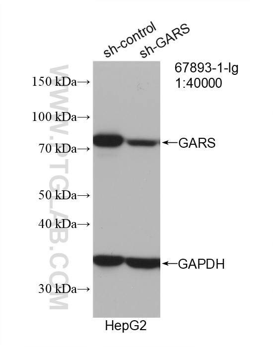 Western Blot (WB) analysis of HepG2 cells using GARS Monoclonal antibody (67893-1-Ig)