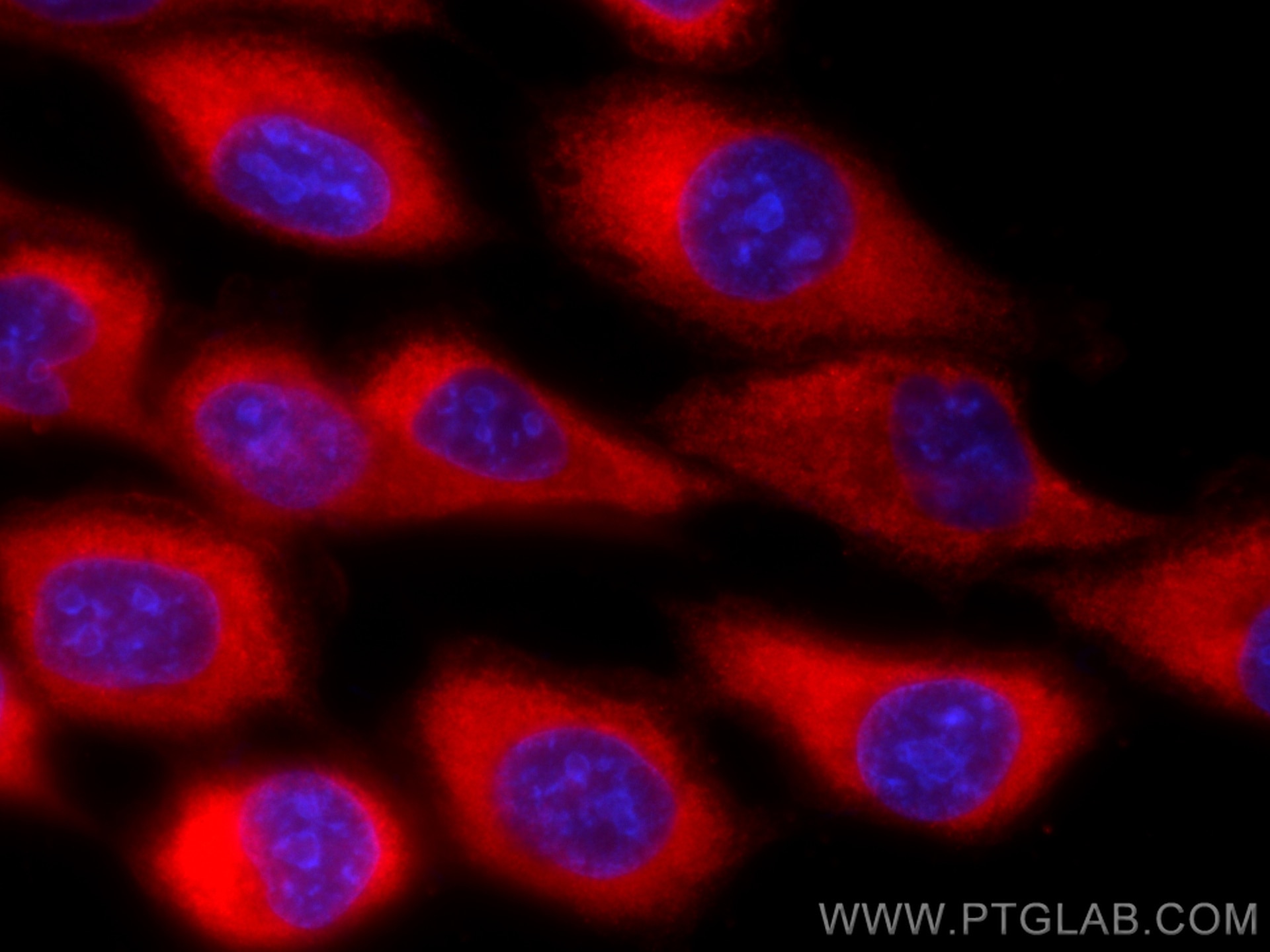 Immunofluorescence (IF) / fluorescent staining of A431 cells using CoraLite®594-conjugated GARS Monoclonal antibody (CL594-67893)