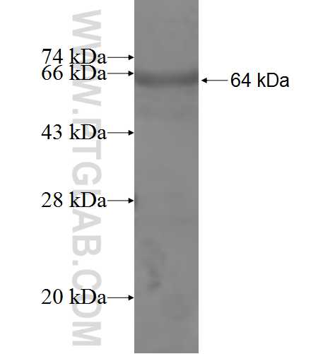 GARS fusion protein Ag8322 SDS-PAGE