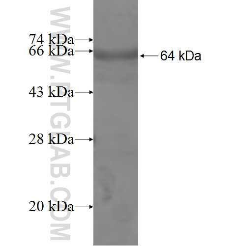 GARS fusion protein Ag8322 SDS-PAGE