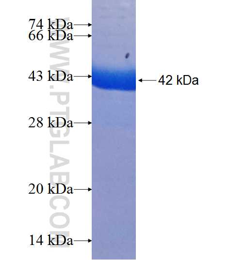 GARS fusion protein Ag8432 SDS-PAGE