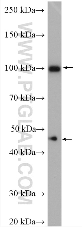 Western Blot (WB) analysis of HeLa cells using GART Polyclonal antibody (13659-1-AP)