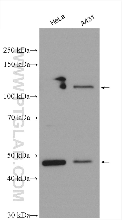 Western Blot (WB) analysis of various lysates using GART Polyclonal antibody (13659-1-AP)