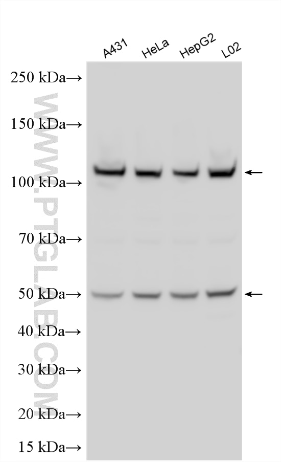 Western Blot (WB) analysis of various lysates using GART Polyclonal antibody (13659-1-AP)