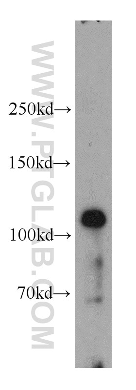 Western Blot (WB) analysis of HepG2 cells using GART Polyclonal antibody (13659-1-AP)