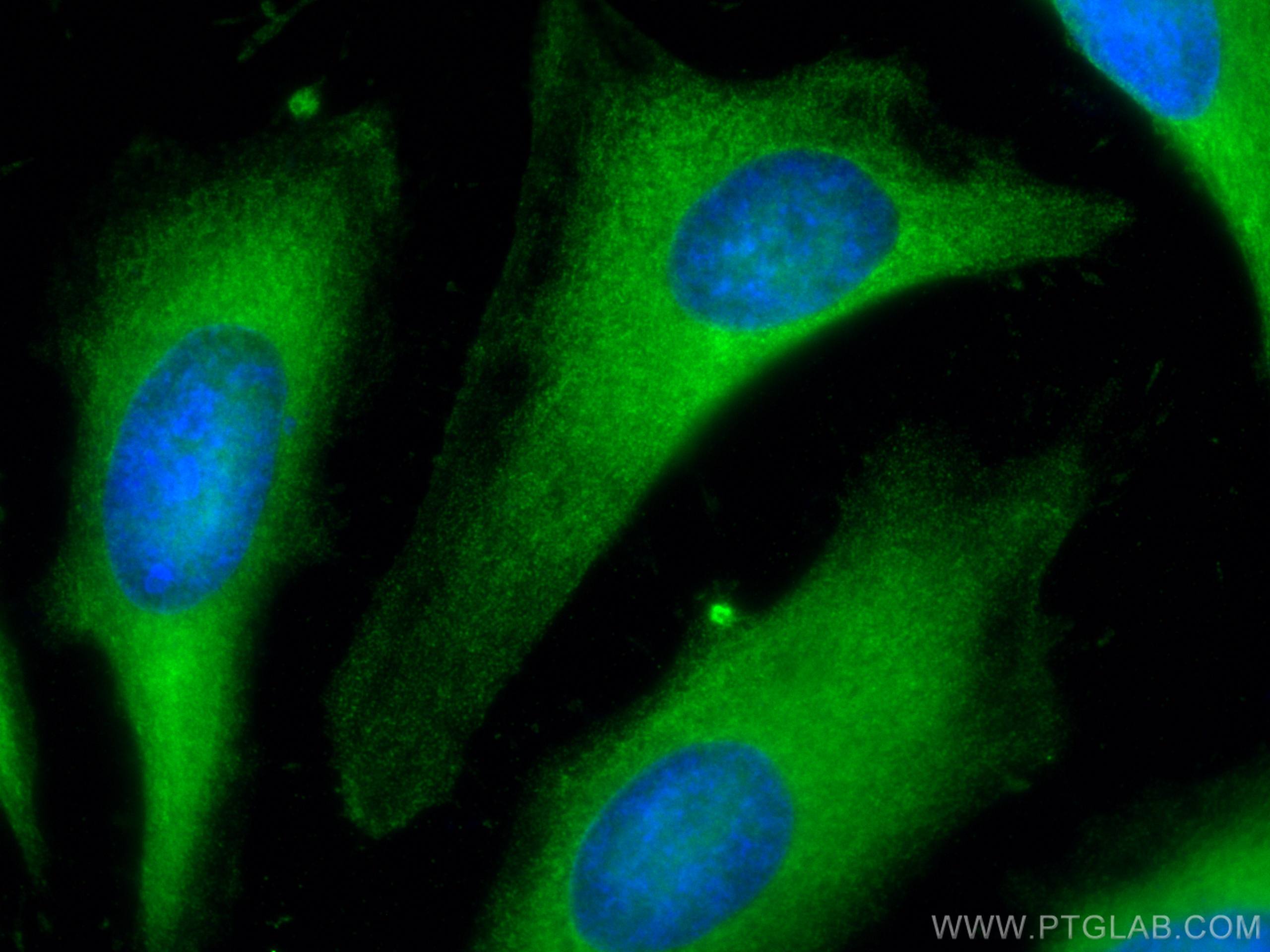 Immunofluorescence (IF) / fluorescent staining of HeLa cells using GART Monoclonal antibody (67939-1-Ig)