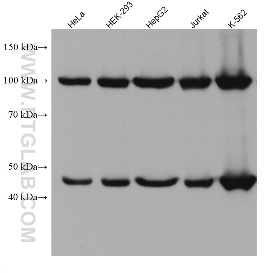 Western Blot (WB) analysis of various lysates using GART Monoclonal antibody (67939-1-Ig)