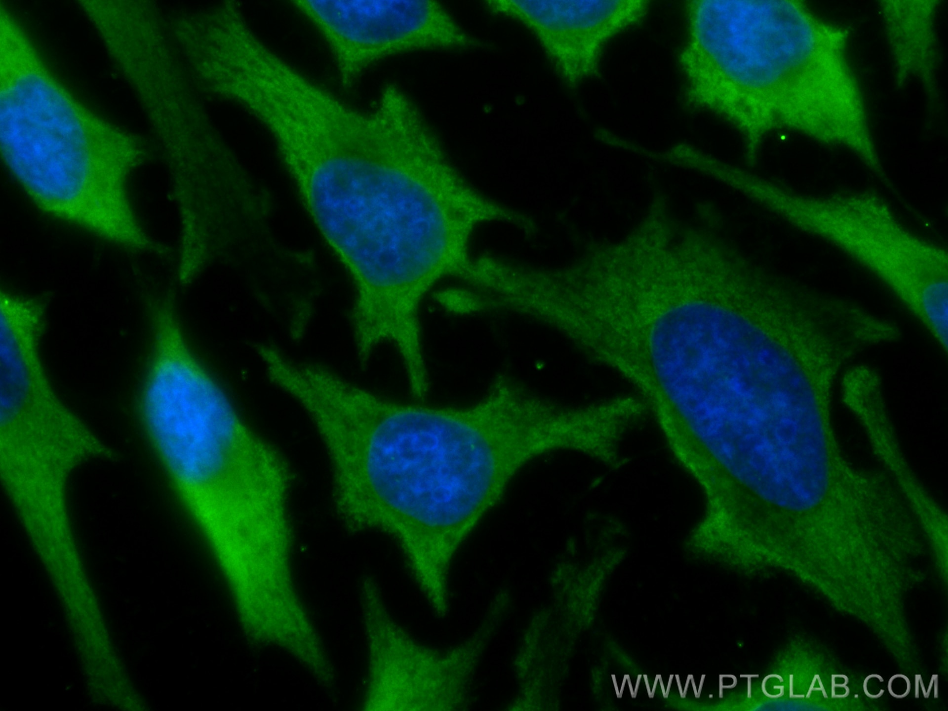 Immunofluorescence (IF) / fluorescent staining of HeLa cells using CoraLite® Plus 488-conjugated GART Monoclonal anti (CL488-67939)