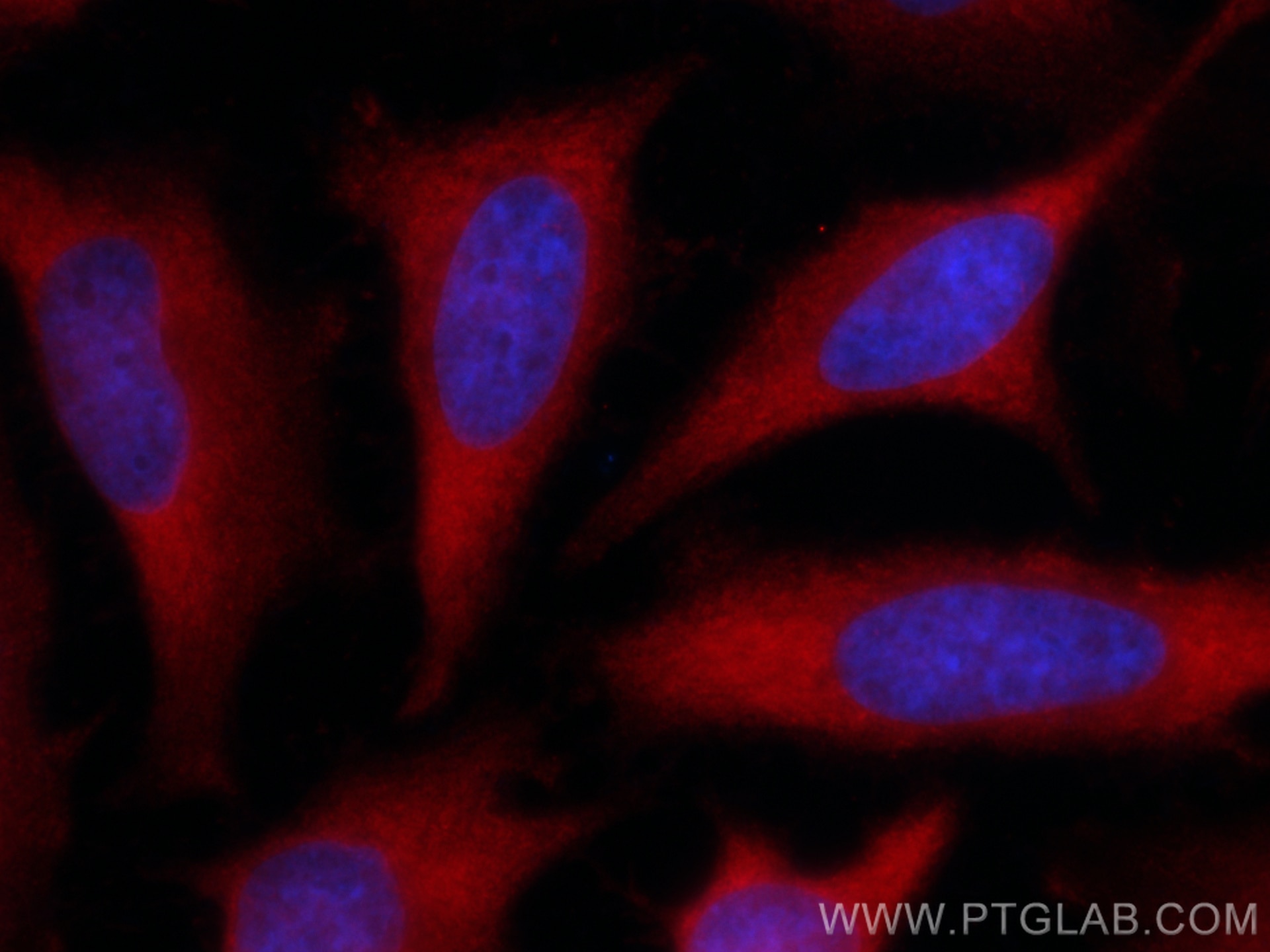 Immunofluorescence (IF) / fluorescent staining of HeLa cells using CoraLite®594-conjugated GART Monoclonal antibody (CL594-67939)