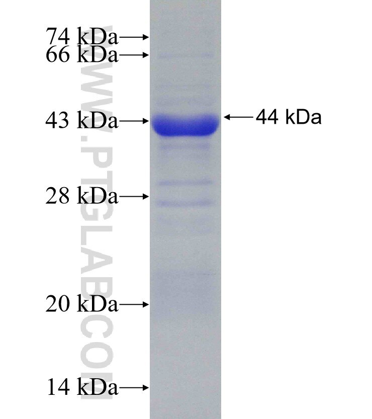 GART fusion protein Ag30509 SDS-PAGE