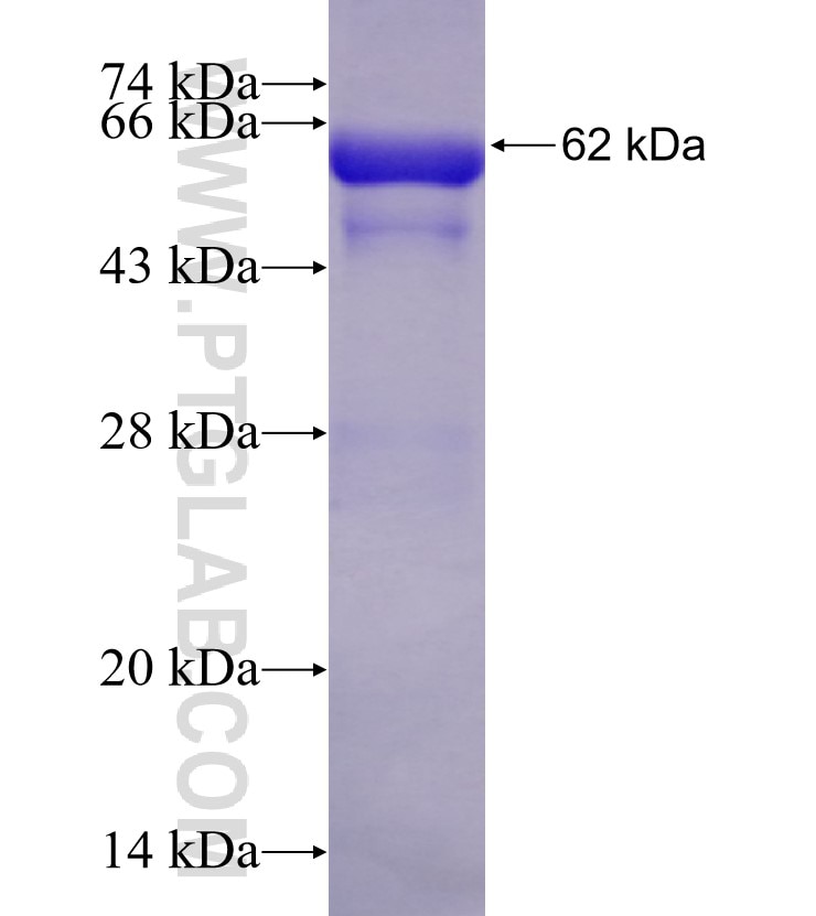 GART fusion protein Ag4555 SDS-PAGE