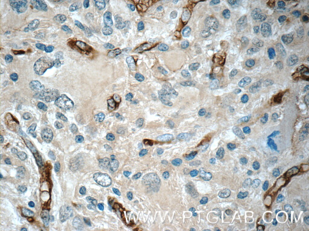 GAS1 Polyclonal antibody