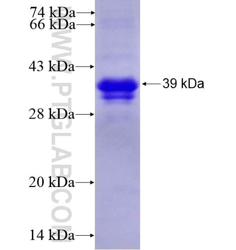 GAS1 fusion protein Ag12259 SDS-PAGE