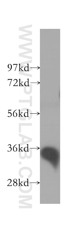 Western Blot (WB) analysis of human kidney tissue using GAS2 Polyclonal antibody (11941-2-AP)
