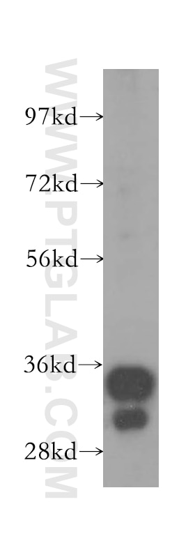 Western Blot (WB) analysis of human liver tissue using GAS2 Polyclonal antibody (11941-2-AP)