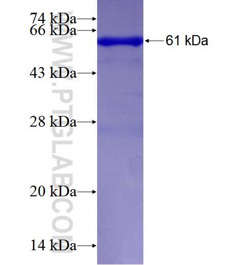GAS2 fusion protein Ag2540 SDS-PAGE
