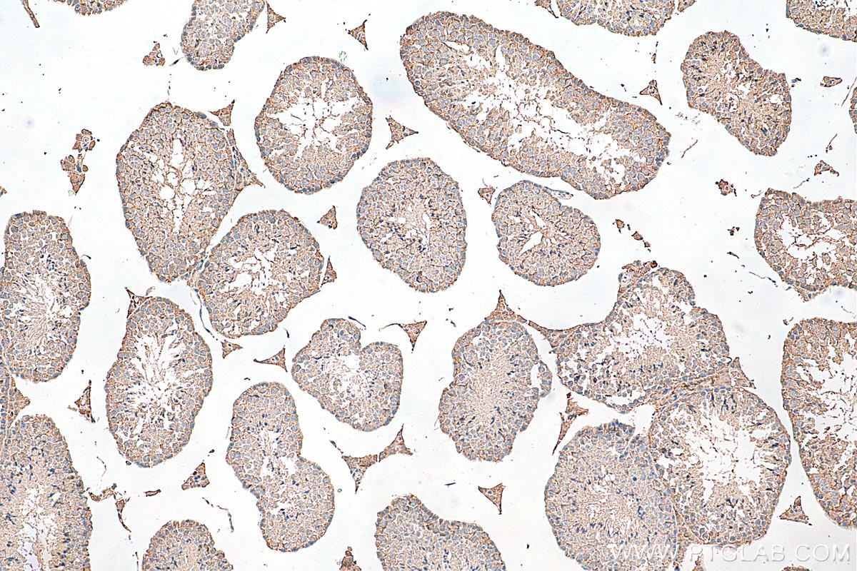 Immunohistochemistry (IHC) staining of mouse testis tissue using GAS2L1 Monoclonal antibody (68051-1-Ig)