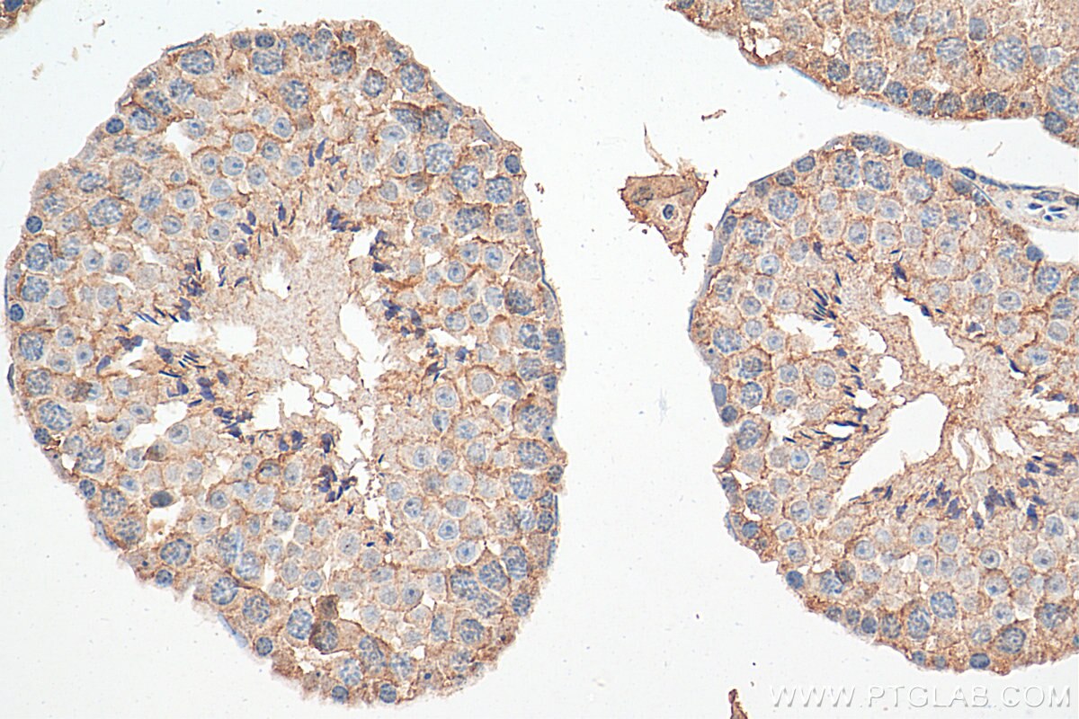 Immunohistochemistry (IHC) staining of mouse testis tissue using GAS2L1 Monoclonal antibody (68051-1-Ig)