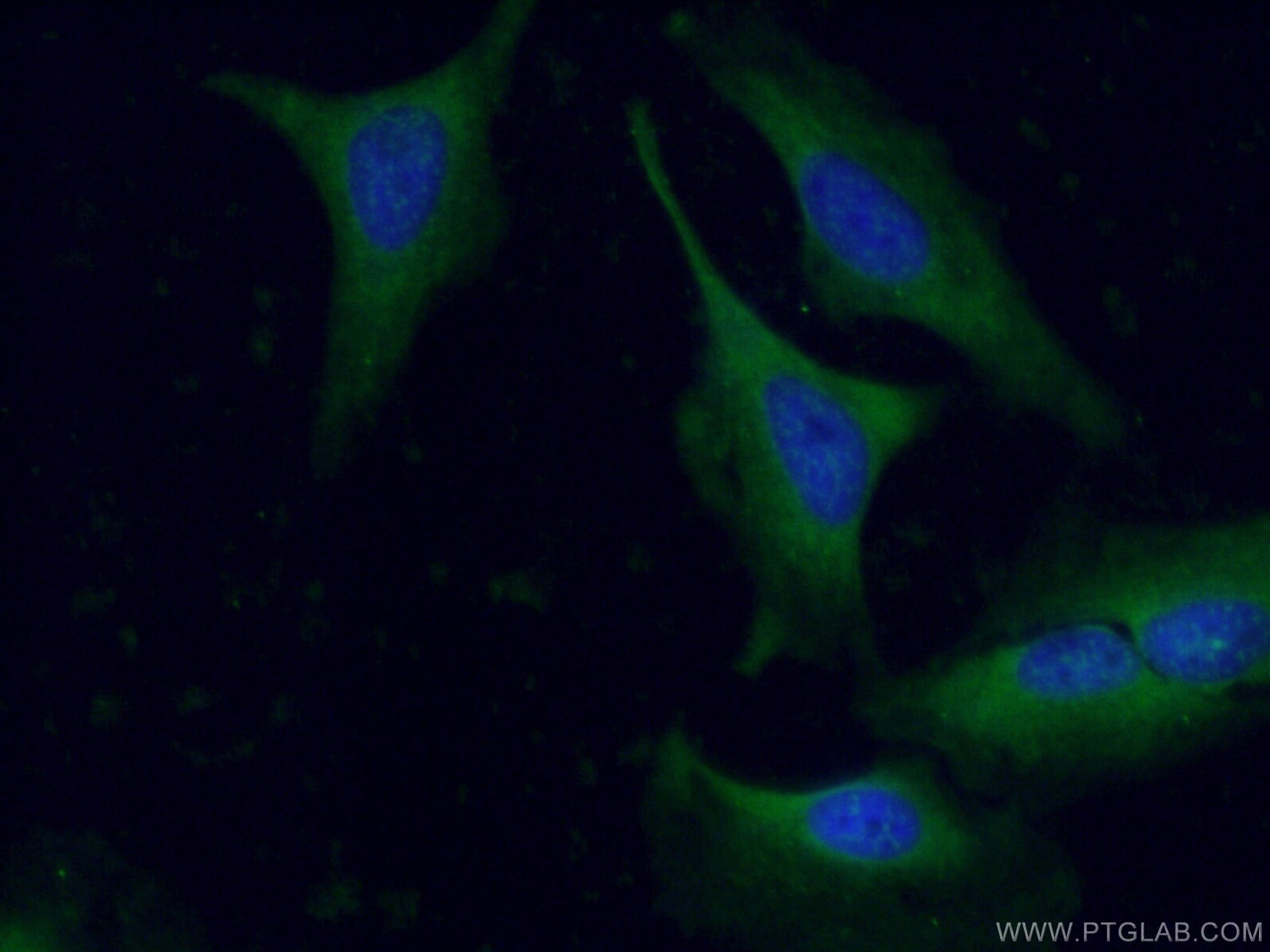 Immunofluorescence (IF) / fluorescent staining of HeLa cells using GAS6 Polyclonal antibody (13795-1-AP)