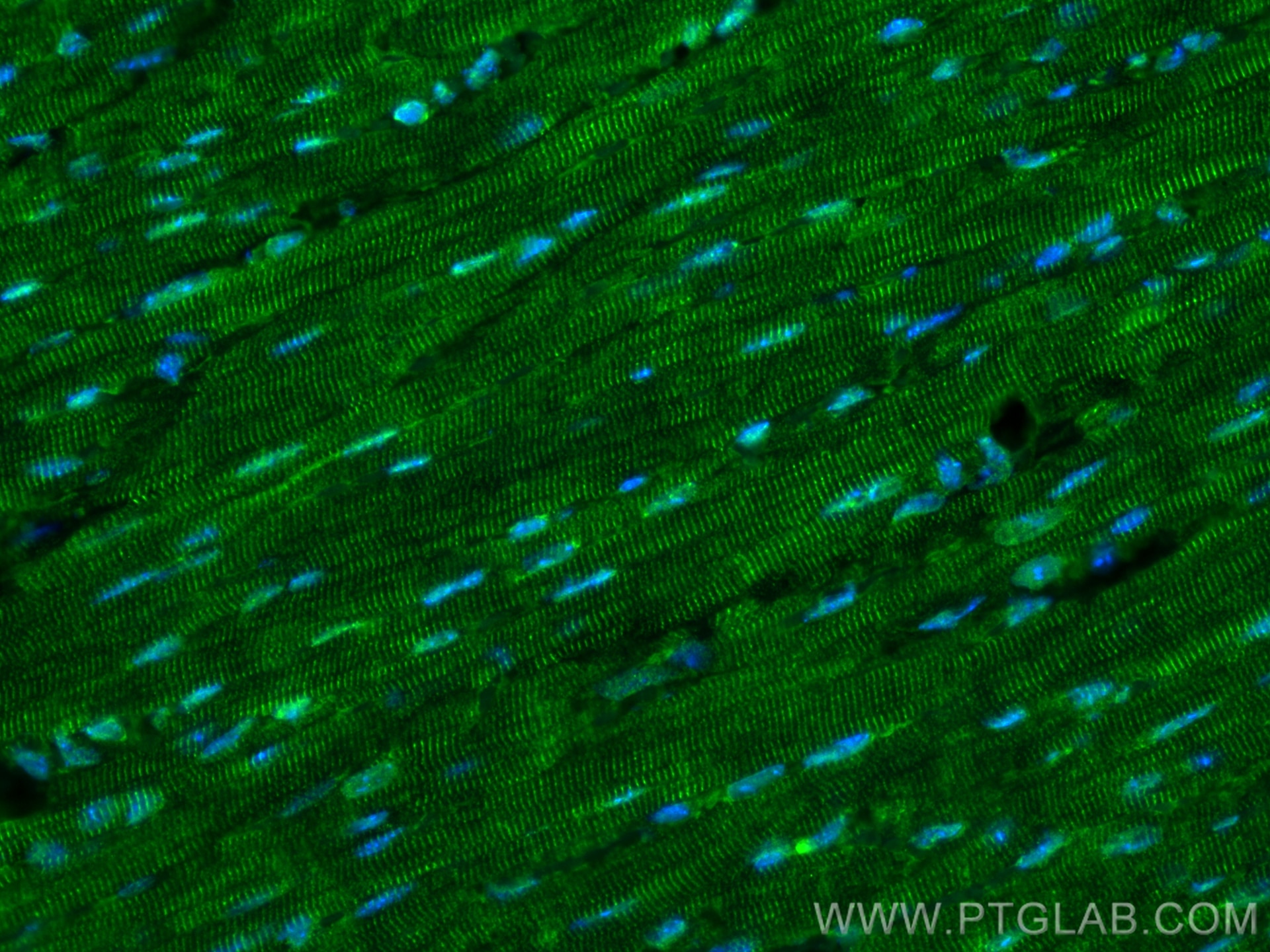 Immunofluorescence (IF) / fluorescent staining of mouse heart tissue using GAS6 Polyclonal antibody (13795-1-AP)