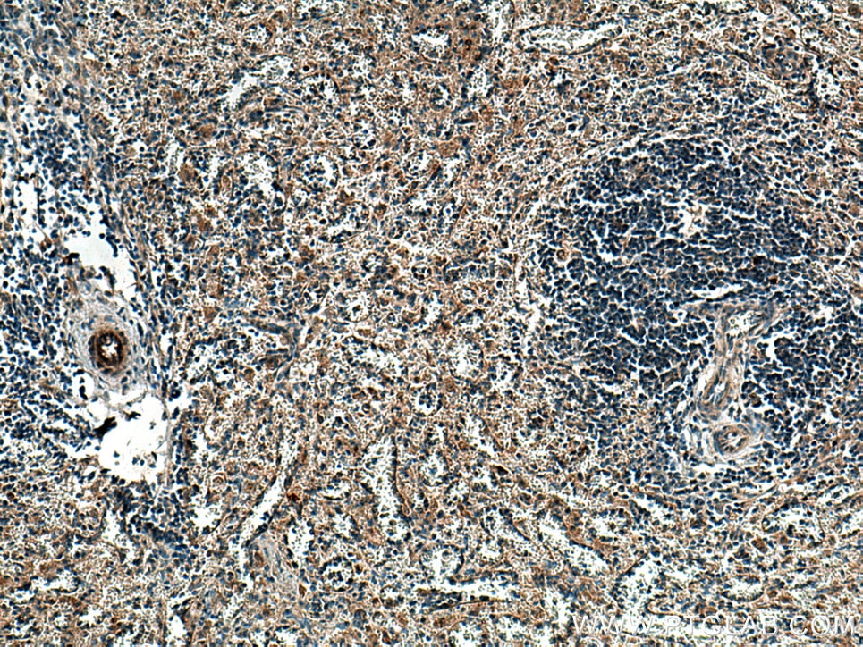 Immunohistochemistry (IHC) staining of human spleen tissue using GAS6 Polyclonal antibody (13795-1-AP)