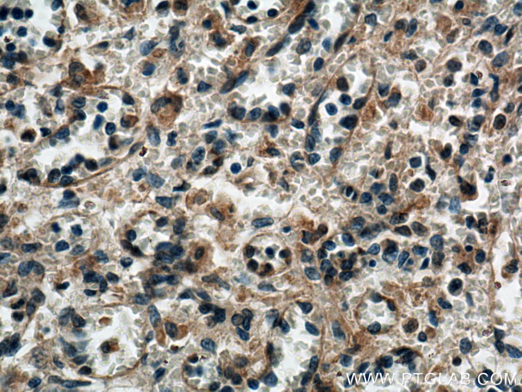 IHC staining of human spleen using 13795-1-AP