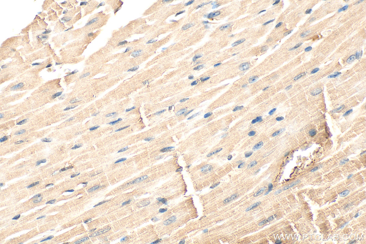 Immunohistochemistry (IHC) staining of mouse heart tissue using GAS6 Polyclonal antibody (13795-1-AP)