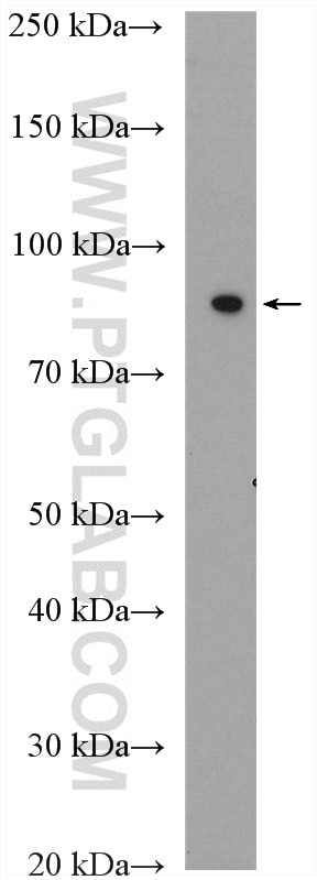 Western Blot (WB) analysis of human urine sample using GAS6 Polyclonal antibody (13795-1-AP)