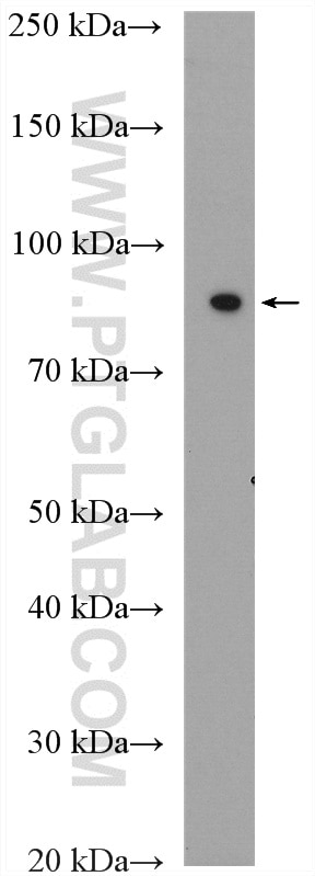 WB analysis of human urine using 13795-1-AP