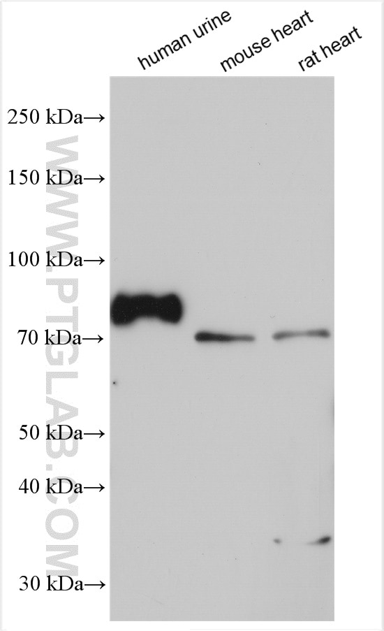 Western Blot (WB) analysis of various lysates using GAS6 Polyclonal antibody (13795-1-AP)