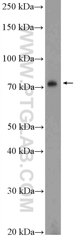 Western Blot (WB) analysis of DU 145 cells using GAS6 Polyclonal antibody (13795-1-AP)