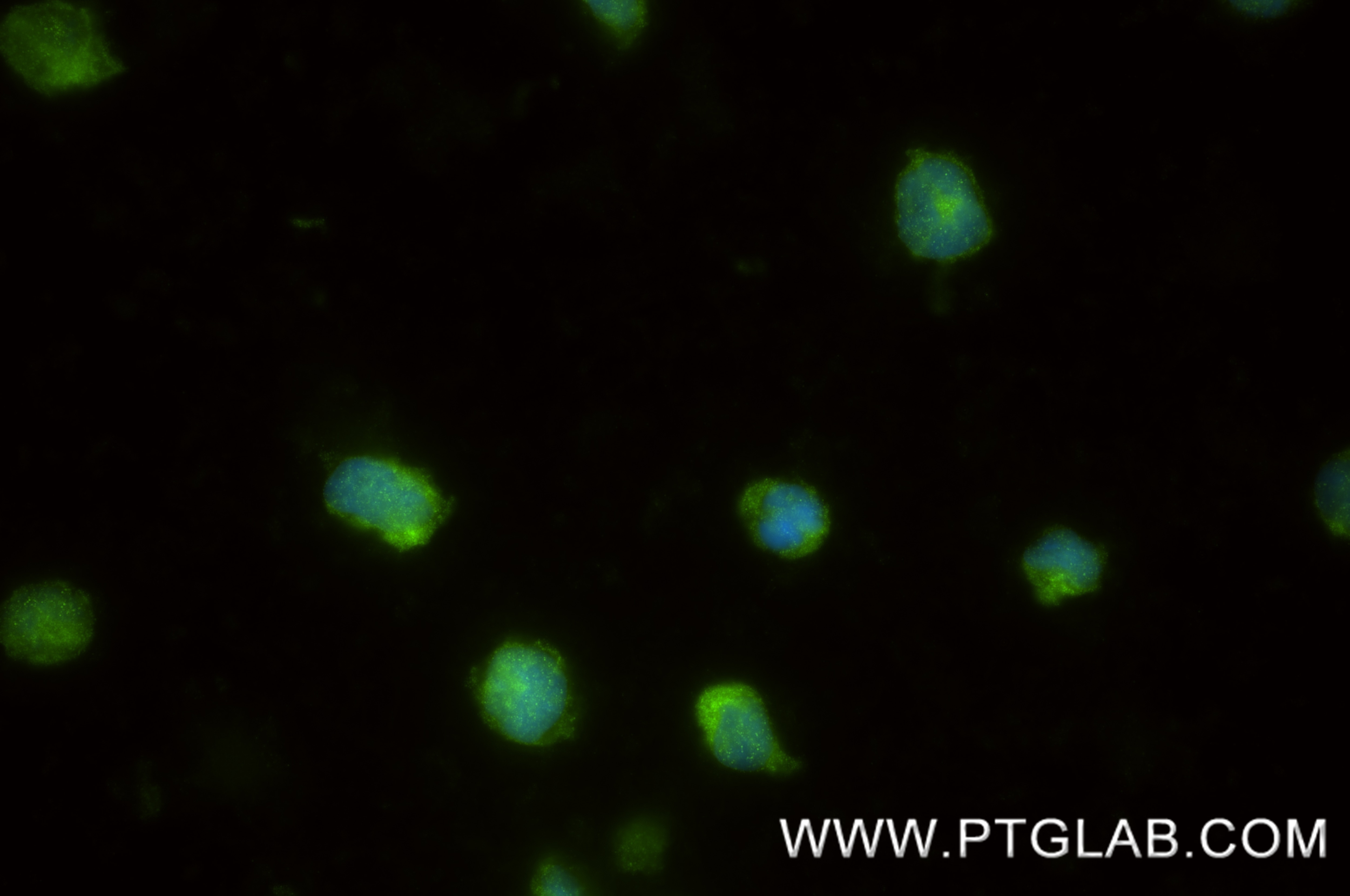 IF Staining of THP-1 using 87249-1-RR Immunofluorescence (IF) / fluorescent staining of THP-1 cells using GAS6 Recombinant monoclonal antibody (87249-1-RR)