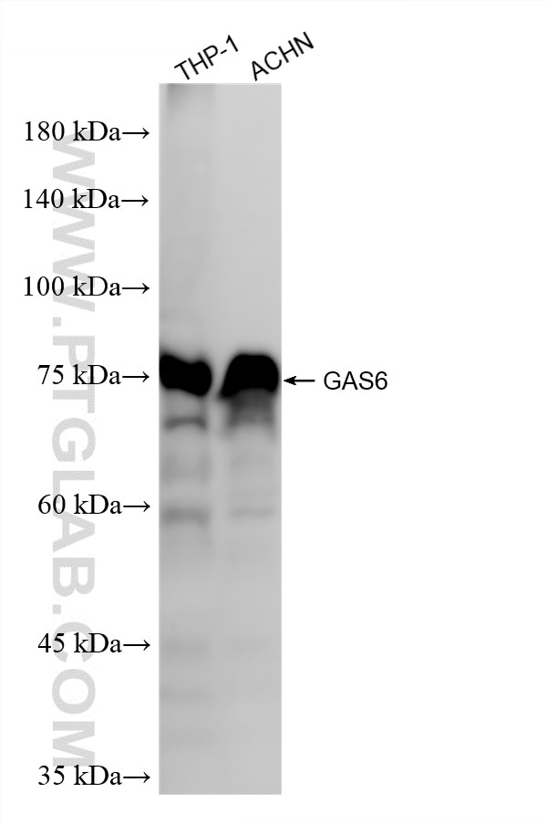 Western Blot (WB) analysis of various lysates using GAS6 Recombinant monoclonal antibody (87249-1-RR)