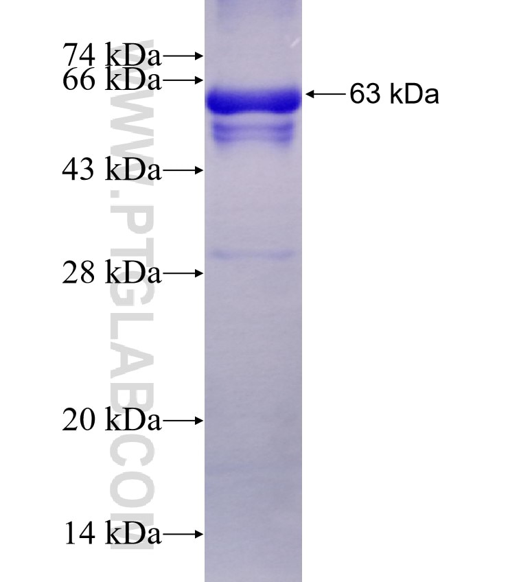 GAS6 fusion protein Ag4617 SDS-PAGE