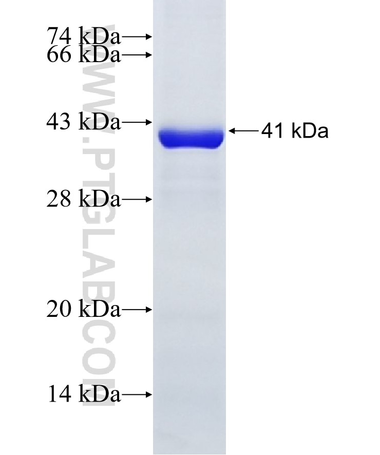 GAS6 fusion protein Ag5158 SDS-PAGE