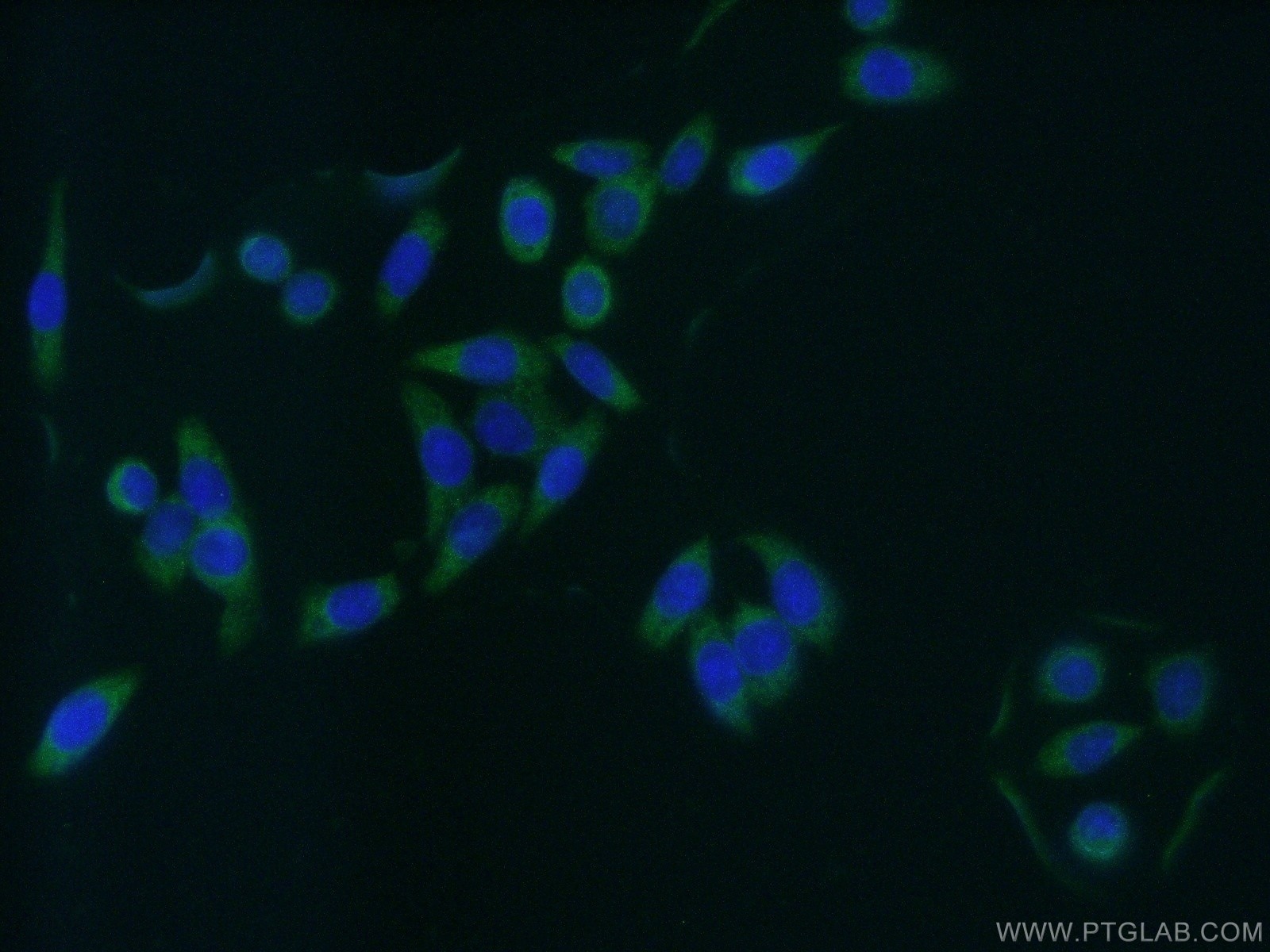 IF Staining of HeLa using 10072-1-AP